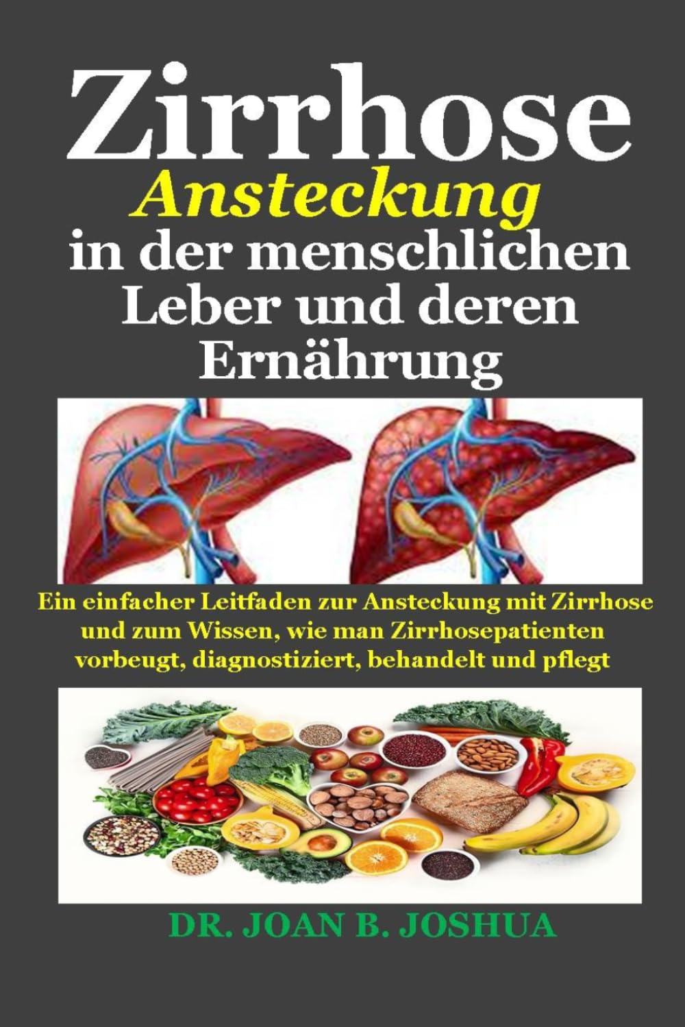 Zirrhose-Ansteckung in der menschlichen Leber und deren Ernährung: Ein einfacher Leitfaden zur Ansteckung mit Zirrhose und zum Wissen,wie man Zirrhosepatienten vorbeugt,diagnostiziert, behandelt und Health, Nutrition & Fitness