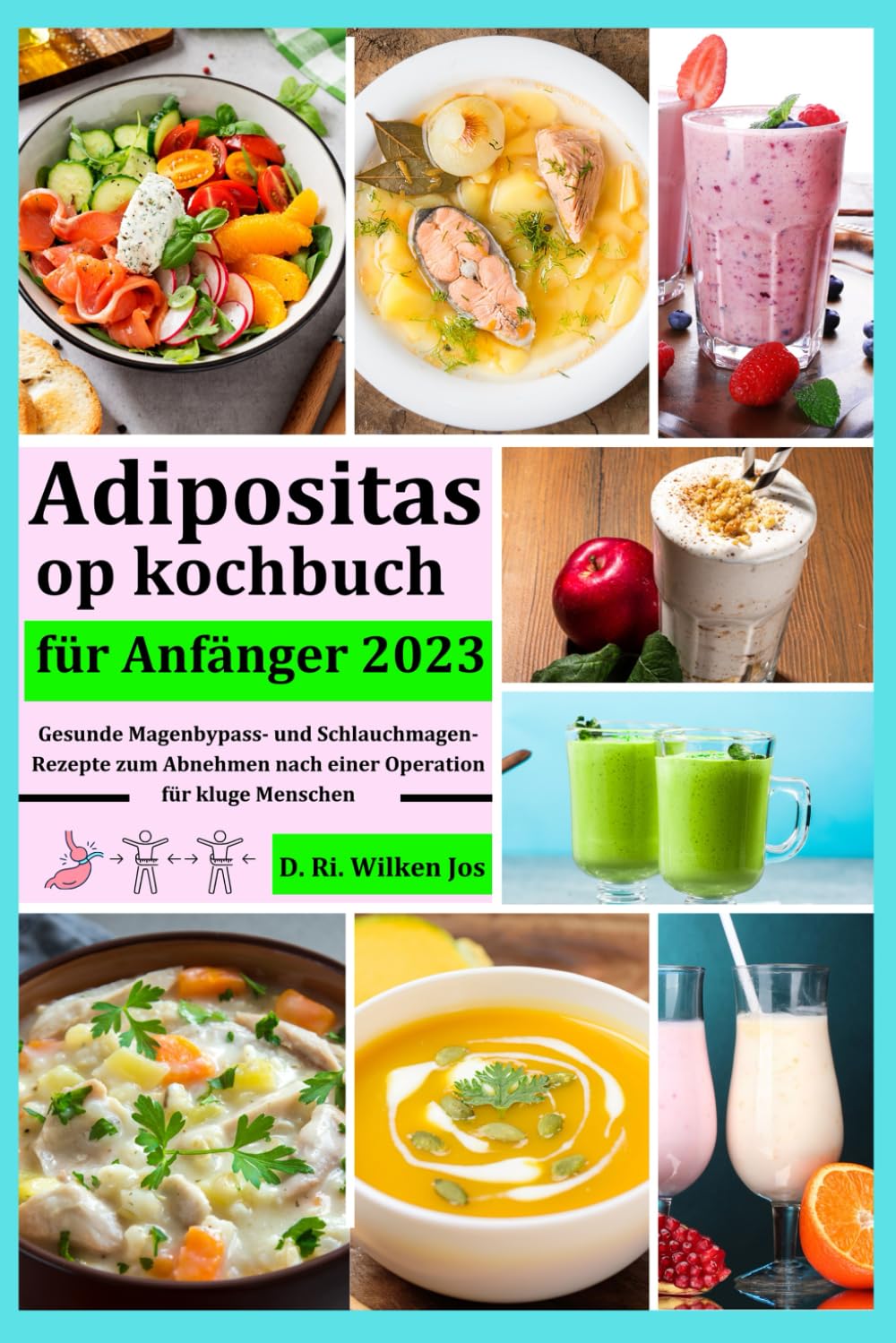 Adipositas op kochbuch für anfänger: Gesunde Magenbypass- und Schlauchmagen-Rezepte zum Abnehmen nach einer Operation für kluge Menschen: Gesunde ... nach einer Operation fr kluge Menschen Health, Nutrition & Fitness