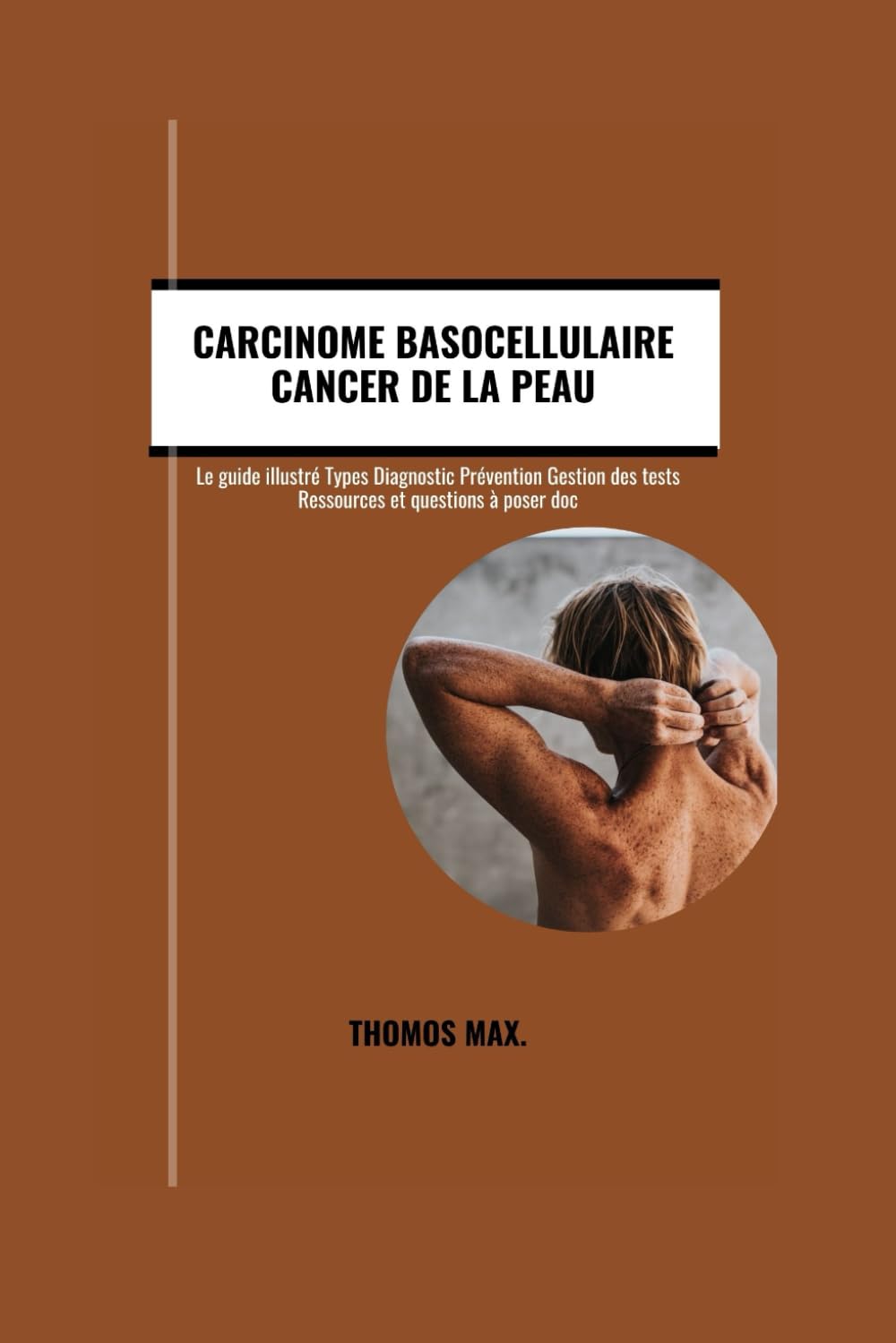 LECARCINOME BASOCELLULAIRE CANCERDELAPEAU.: Leguideillustré:TypesDiagnosticPrévention GestiondestestsRessourcesetquestionsàposer àvotremédecin. book