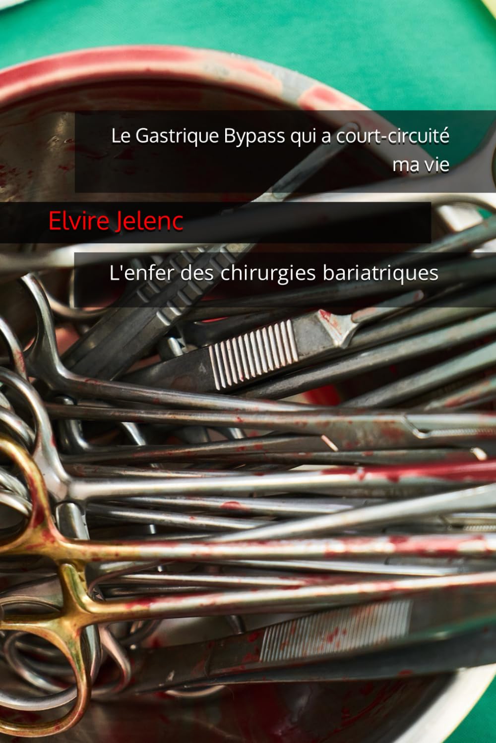 Le Gastrique Bypass qui a court-circuité ma vie book