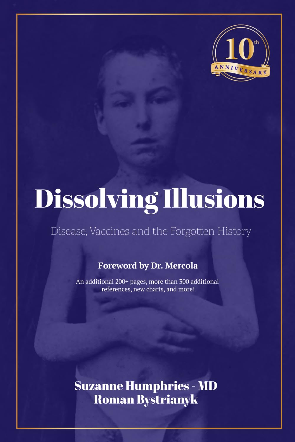 Dissolving Illusions: Disease, Vaccines, and the Forgotten History 10th Anniversary Edition Medicine